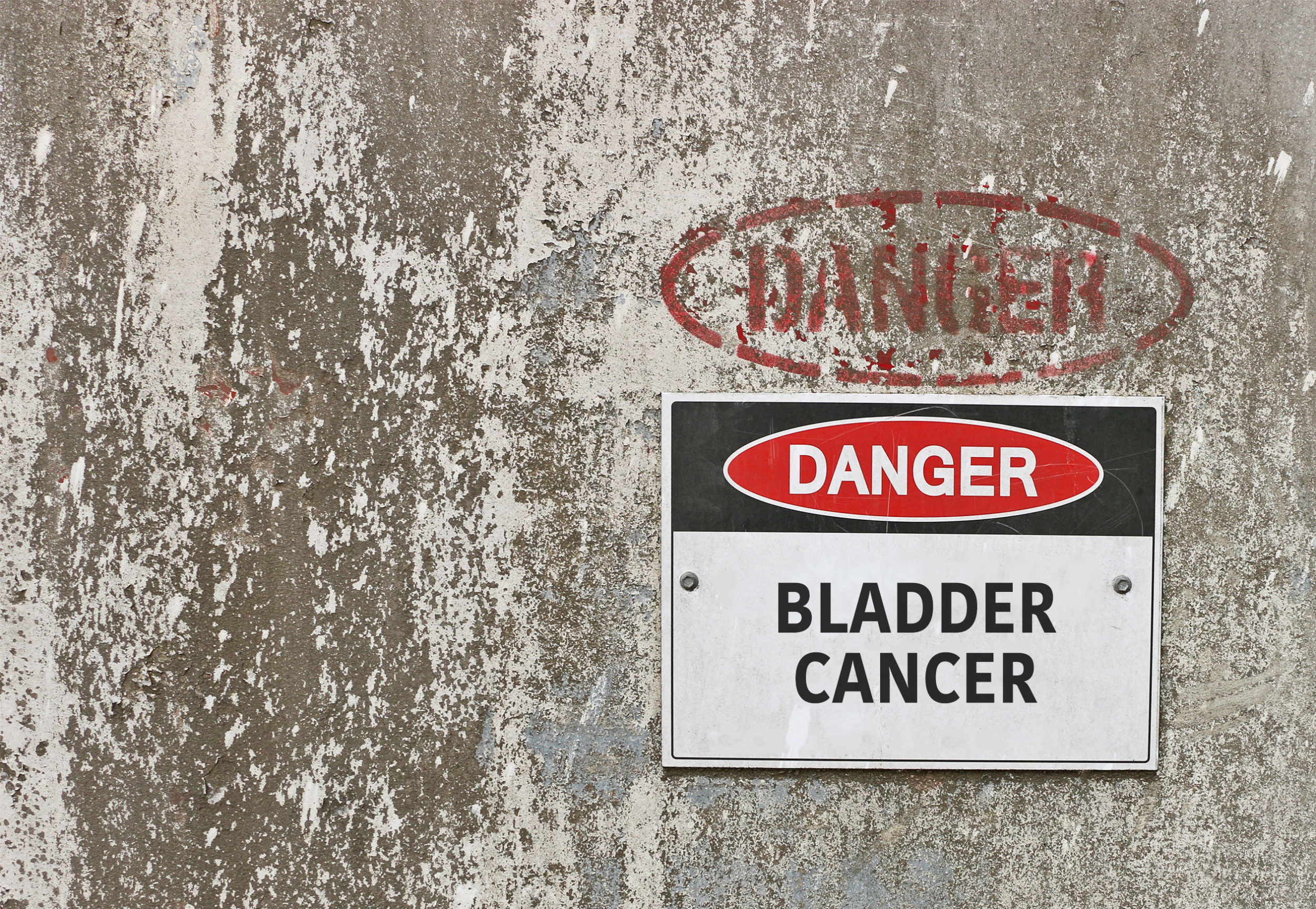 Do You Know The Warning Signs Of Bladder Cancer Inova Newsroom